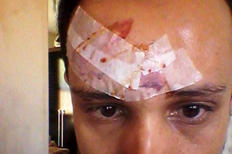 Maquiador é vítima de homofobia em Poços