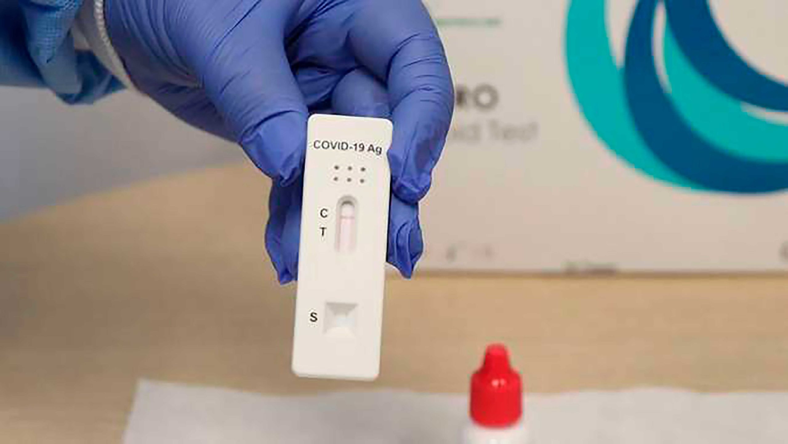 Laboratório de Poços oferece testes para detecção da covid-19