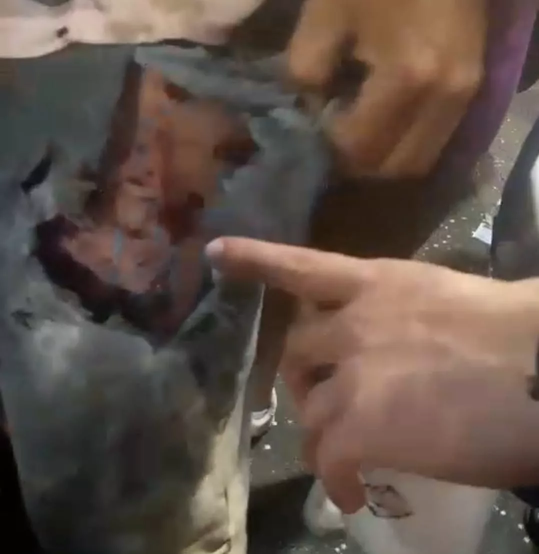 Vídeo mostra foliões em busca de atendimento junto a ambulâncias