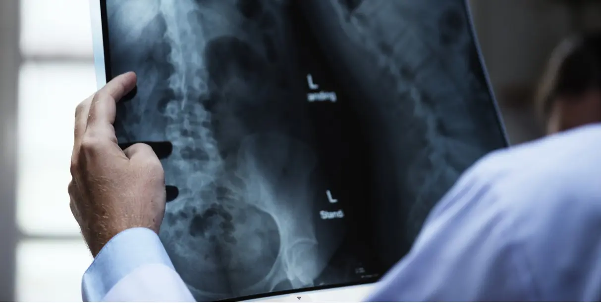 Poços tem mais de mil pacientes na fila para exame de densitometria óssea