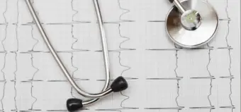 Novembro terá mutirão de exames cardiológicos na rede de Saúde de Poços